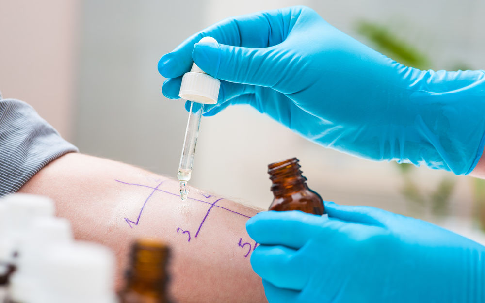 Allergien: Ursachen, Diagnose und Behandlungsmöglichkeiten