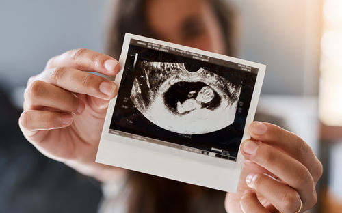 Während der Schwangerschaft: Auf diese Dinge sollten Frauen achten