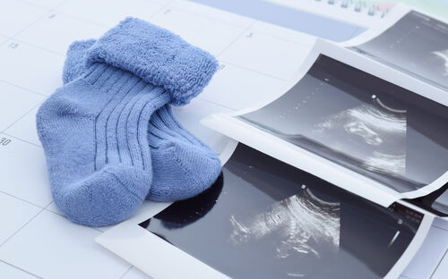 Mutter-Kind-Pass: Das erwartet Sie bei den Untersuchungen