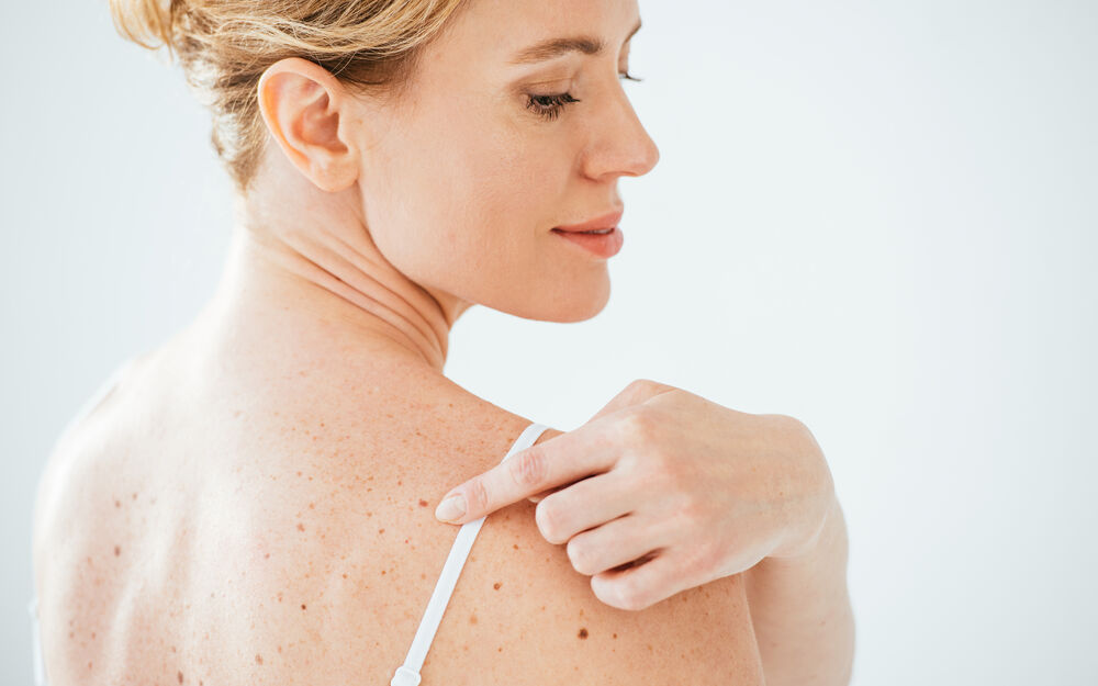 Hautkrebs immer besser behandelbar – Früherkennung bleibt zentral!