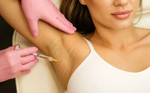 Hyperhidrose: Schweißfrei in den Sommer!