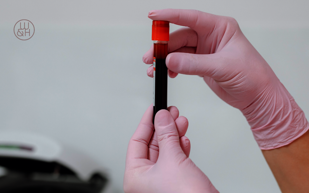 HPV-Cotestung: Wissen, das schützt