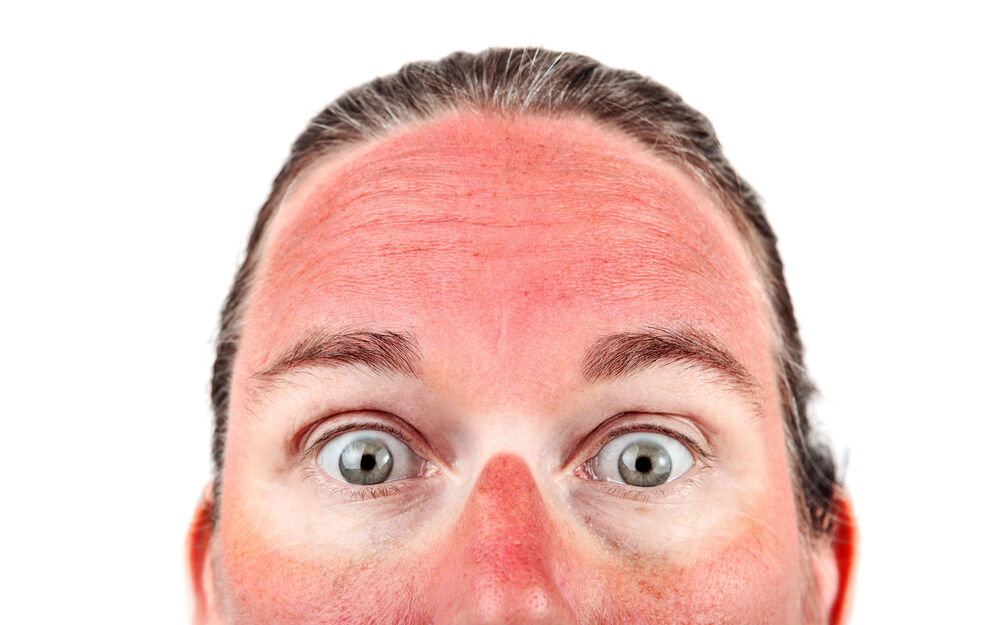 Hautkrebs-Vorsorge: Im Sommer wichtiger denn je