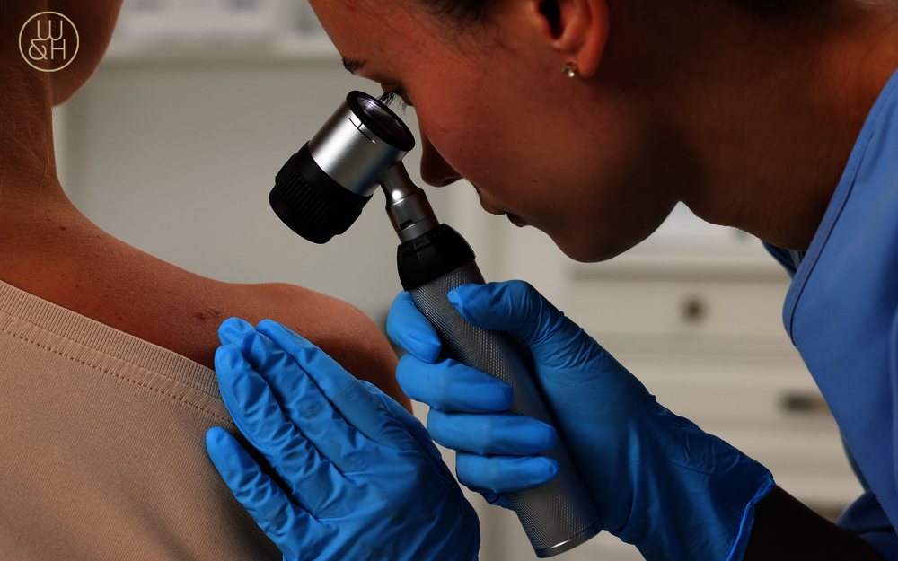 Wachsamkeit gegenüber weißem Hautkrebs: Vorbeugung und Früherkennung