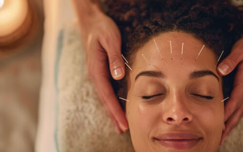 Schwangerschafts-Stress: Sanfte Akupunktur statt auf Nadeln sitzen