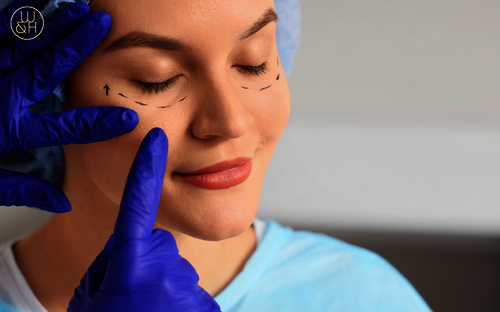 Lidkorrektur: Mit Mini-Eingriff gegen müde Augen