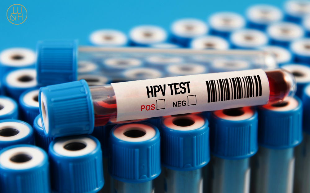 HPV-Infektion erhöht Risiko für Herz-Kreislauf-Erkrankungen