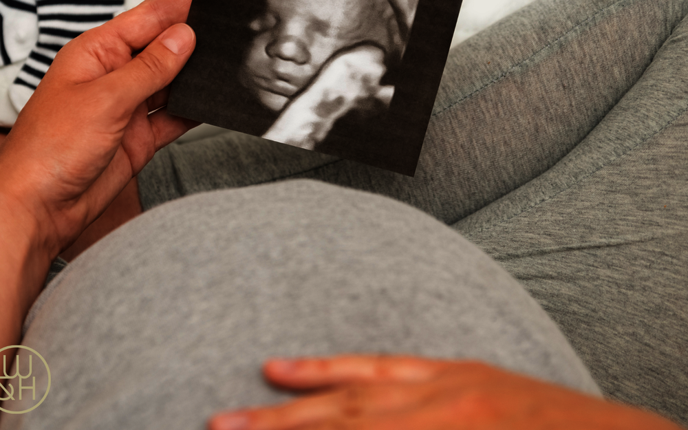 Bauchkino: 3D- und 4D-Ultraschall