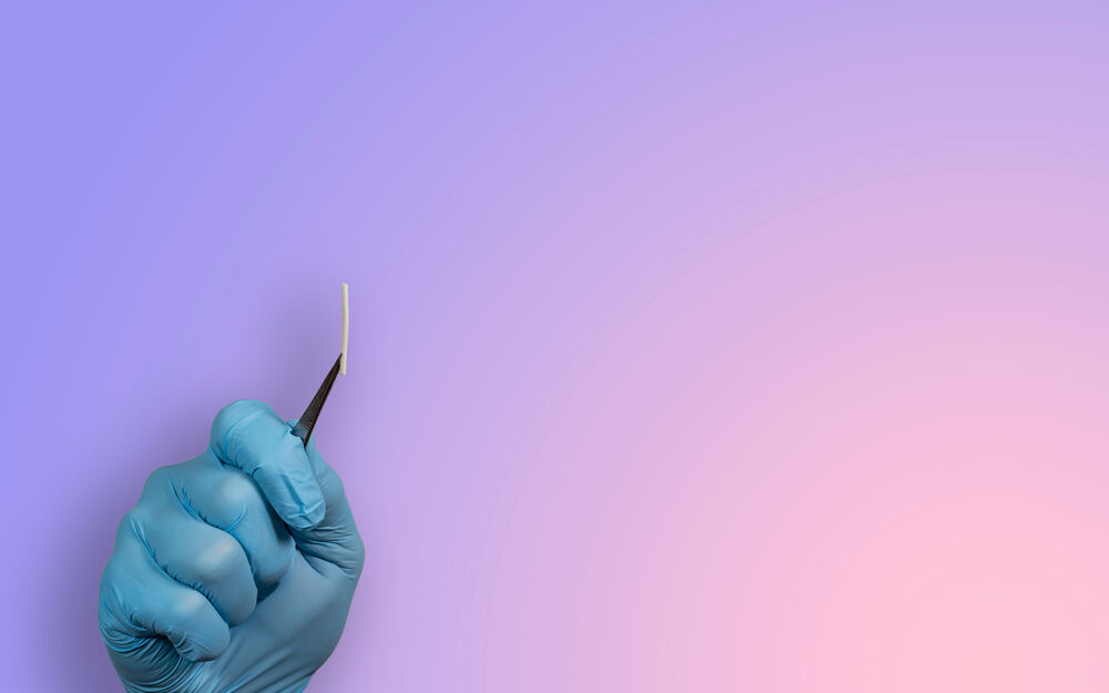 Hormonimplantat: Sichere Verhütung für Frauen in der Stillzeit und mit Östrogen-Unverträglichkeit