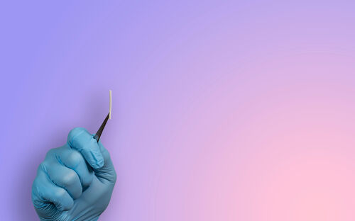 Hormonimplantat: Sichere Verhütung für Frauen in der Stillzeit und mit Östrogen-Unverträglichkeit