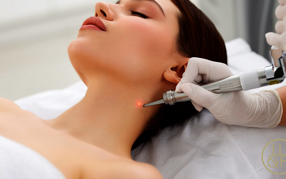 Falten, Narben und Co: Allroundtalent Laser