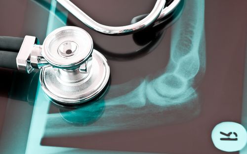 Orthopädische Erkrankungen behandeln und vorbeugen