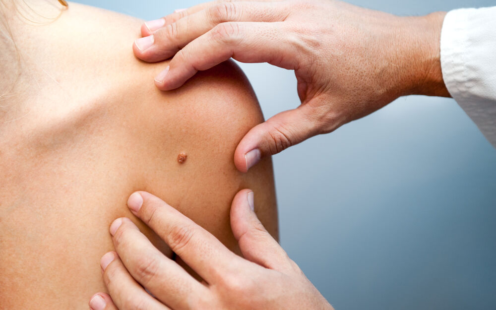 In guten Händen: schonende, sichere Hautkrebsentfernung