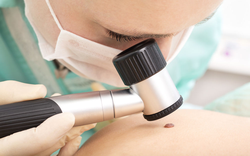Dermatologische Vorsorge: Wieso der regelmäßige Muttermal-Check so wichtig ist