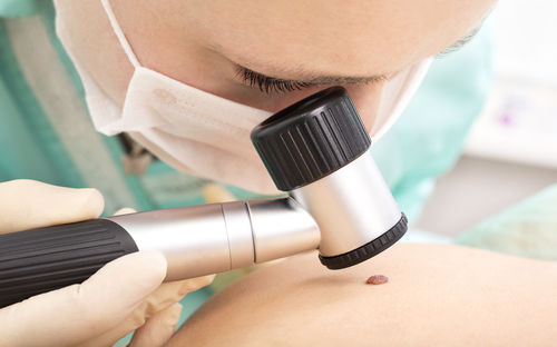 Dermatologische Vorsorge: Wieso der regelmäßige Muttermal-Check so wichtig ist