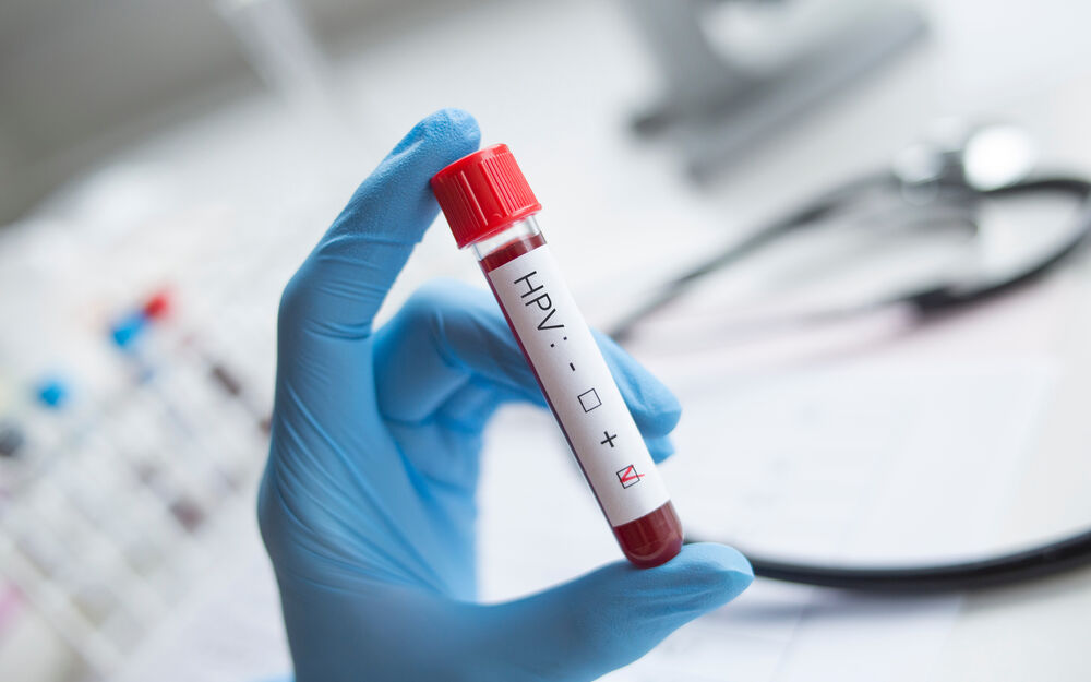 HPV-Infektion = untreu?