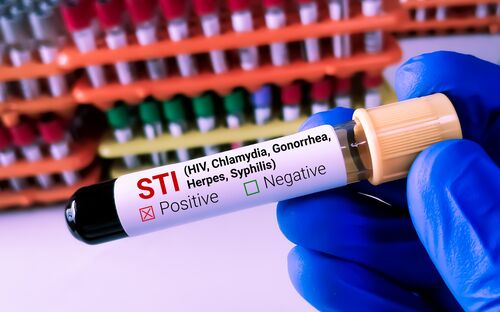 Höchstwerte bei sexuell übertragbaren Krankheiten